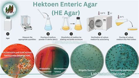 Hektoen Enteric Agar (HE Agar): Purpose, Principles, Composition ...