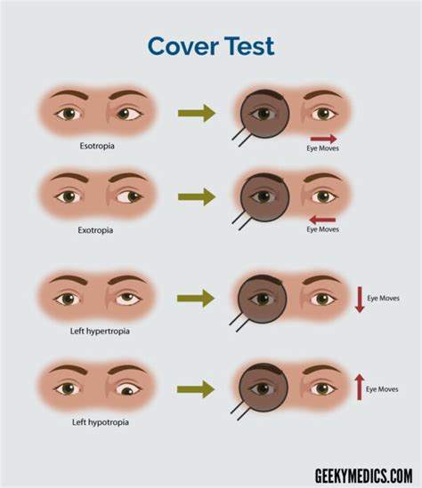 How To Check Cranial Nerves - Signalsteel19