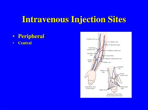 PPT - Parenteral Drug Administration PowerPoint Presentation - ID:471685