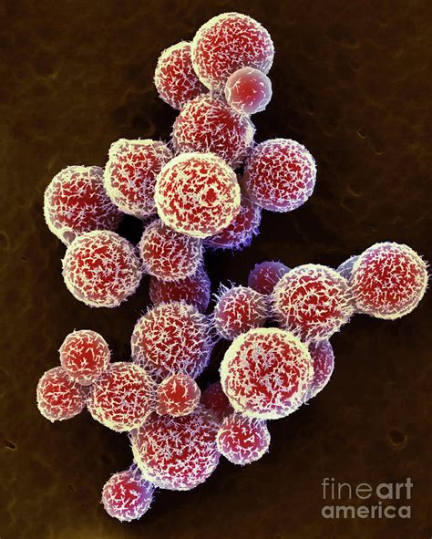 Cryptococcus Neoformans Yeast Photograph by Science Photo Library - Pixels