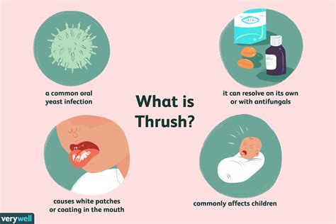 Thrush (Oral Candidiasis): Overview and More