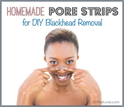 DIY Pore Strips: A Natural Homemade Way to Remove Blackheads