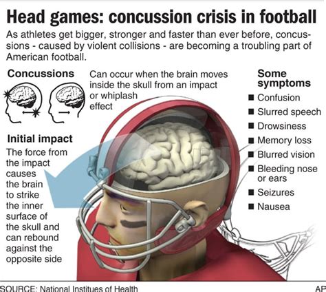 ‘Concussion’ & what you should know about sports and brain injuries ...