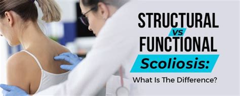 Structural vs Functional Scoliosis: What Is The Difference?