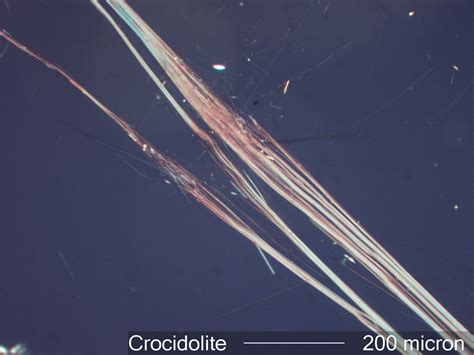 Crocidolite Asbestos Under the Microscope