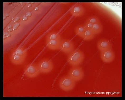 Streptococcus pyogenes | Medical laboratory science, Laboratory science ...