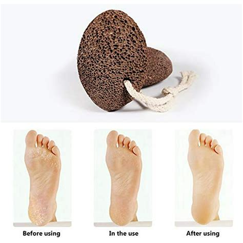 Pumice Stone for feet scrubber - Foot scrubber scrub dead skin removal ...