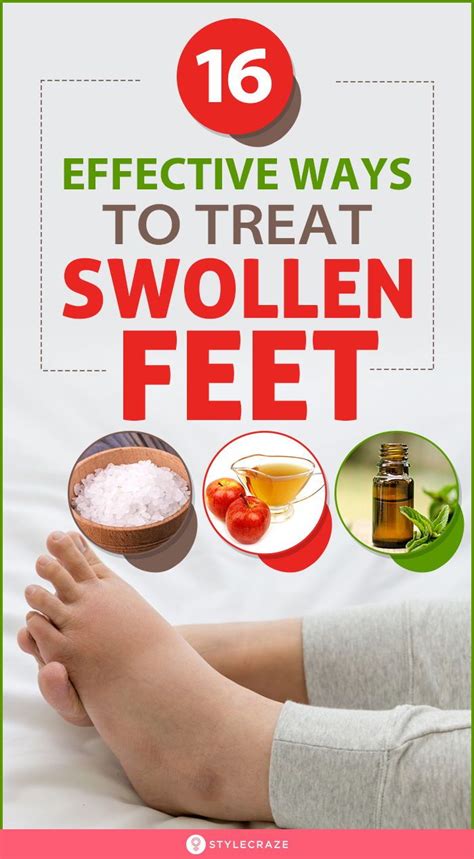 16 home remedies for swollen feet symptoms and treatments – Artofit