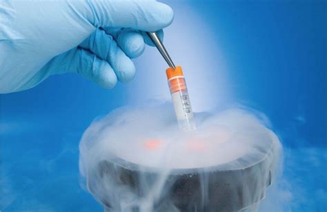 Frozen Embryo Transfer Procedure in Hyderabad | Angels Fertility