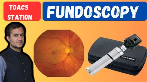 Fundoscopic examination - Fundoscopy made easy - Fundoscopy procedure ...