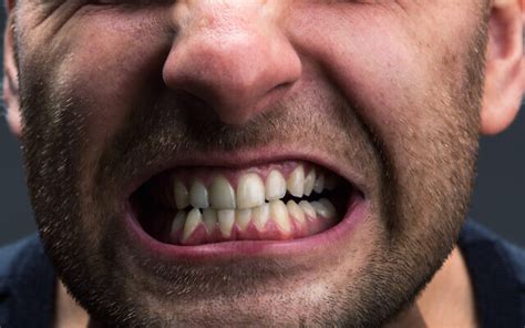 A nation of teeth-grinders, jaw-clenchers: Pandemic’s impact on anxious ...