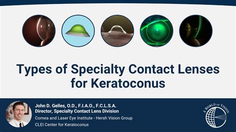 CLEI Center for Keratoconus - Types of Specialty Contact Lenses for ...