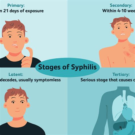 Symptoms Of Syphilis – NBKomputer