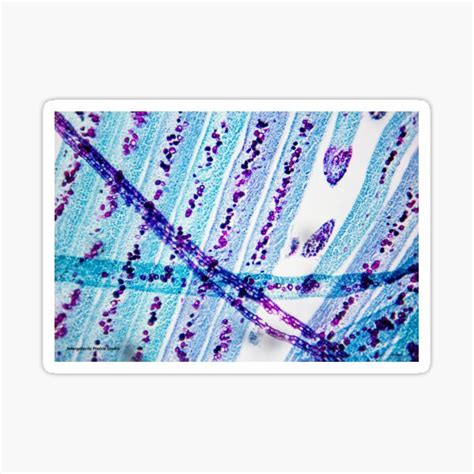 "Microscope Apical Bud Stack" Sticker for Sale by biptunia | Redbubble