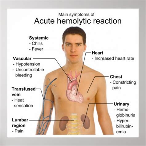 Symptoms of Acute Hemolytic Transfusion Reaction Poster | Zazzle