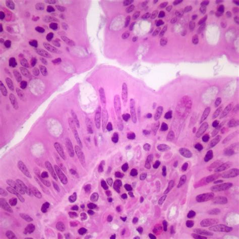 Mammal Simple Columnar Epithelium Slide, thin sec., H&E | Carolina ...