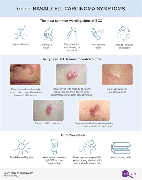 Symptoms Of Skin Cancer On Face