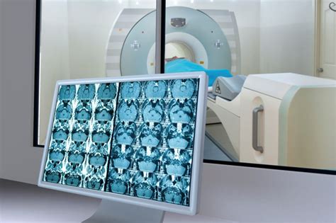 The Parathyroid 4D-CT Scan – For Quick, Accurate Discovery — Radiology ...