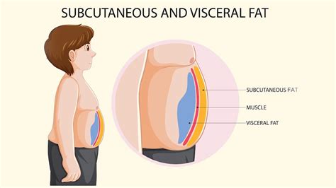 Visceral fat: Here Are Some Remedies To Reduce It | OnlyMyHealth