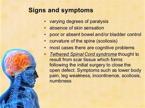 Neurological Disorders