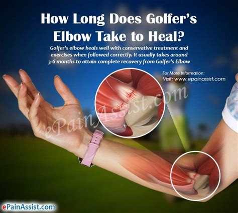 How to fix golfer s tennis elbow inner elbow pain – Artofit