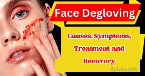 Degloved Face: Causes, Symptoms, Effective Treatment Options, and ...