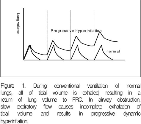 Figure 1 from Measurement of Auto-PEEP | Semantic Scholar