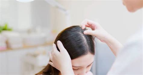 Scalp Eczema Relief: 5 Essential Shampoo Solutions - MindxMaster