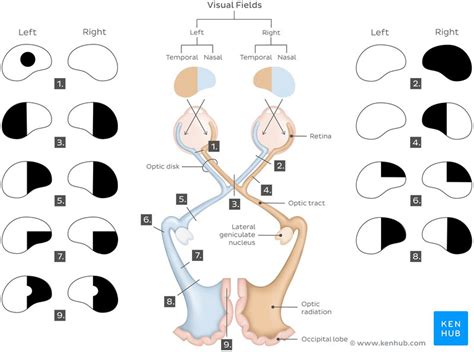 Cranial nerves examination: Optic nerve | Kenhub