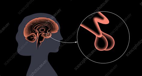 Pituitary gland anatomy, illustration - Stock Image - F036/3698 ...