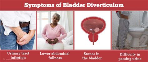 Bladder Diverticulum - Causes, Symptoms, Diagnosis and Management