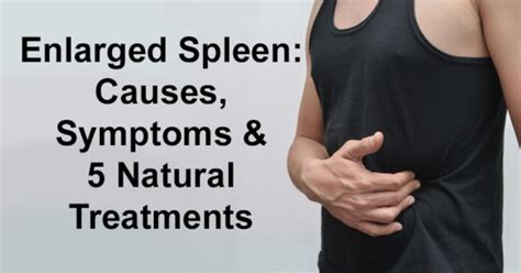 Enlarged Spleen: Causes, Symptoms & 5 Natural Treatments - David ...