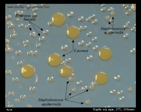 S.epidermidis and S.aureus appearance and colony morphology on agar ...