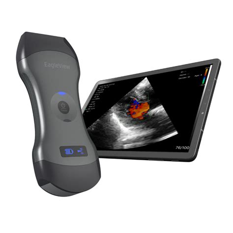 EagleView portable doppler ultrasound, whole-body point-of-care imaging ...