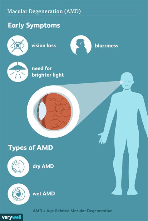 Dry Macular Degeneration: Symptoms, Causes, and Treatments