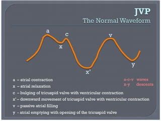 Jugular Venous Pressure (JVP) Jugular Venous Pulse | PPT