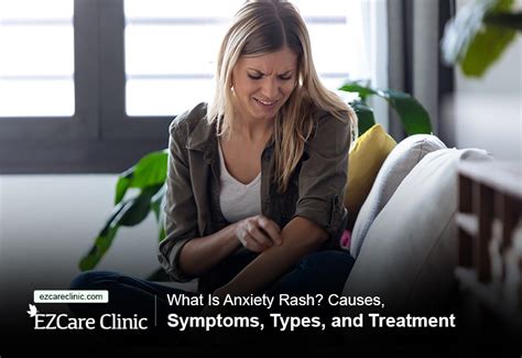 What Is Anxiety Rash? Causes, Symptoms, Types, and Treatment