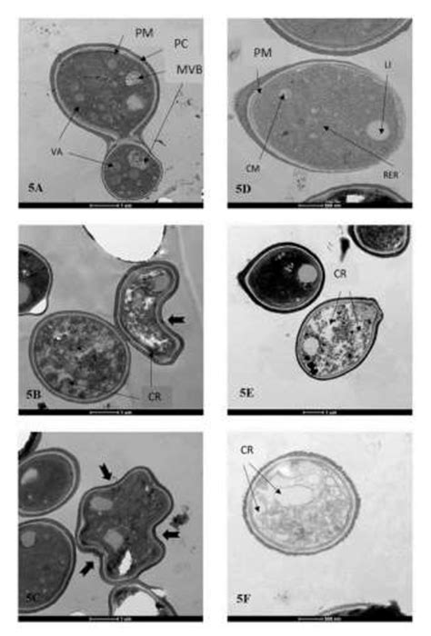 Transmission electron microscopy of Cryptococcus neoformans and ...