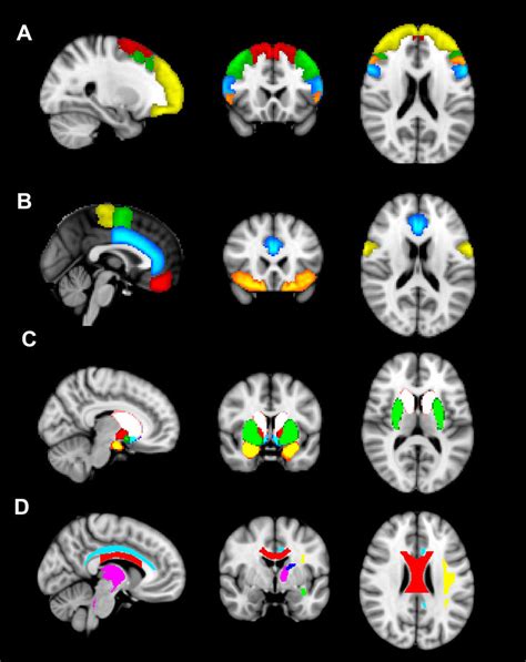 ROI masks for MRI analyses. (A) Frontal pole is shown in yellow ...