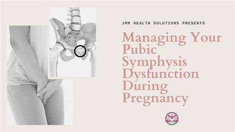 Managing Pubic Symphysis Dysfunction | Irvine Moms