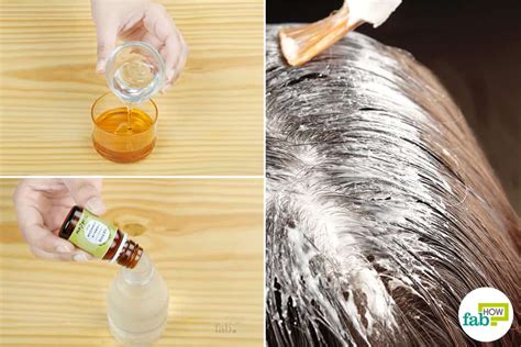 8 Best Home Remedies for Dry, Flaky Scalp That Work | Fab How