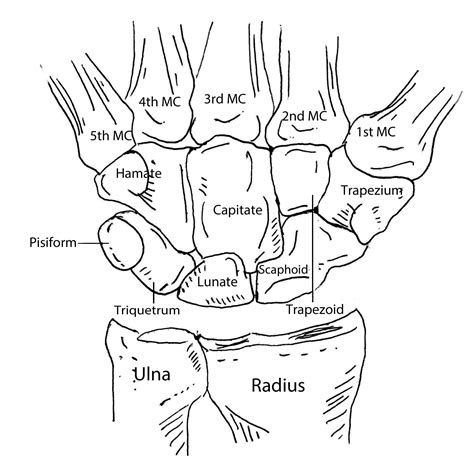 Wrist bones | Anatomy bones, Medical anatomy, Anatomy and physiology