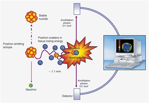 Positron Emission Tomography - Sci-advent - Day 14 - Quantum Tunnel