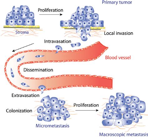 e Schematic representation of the multiple stages of metastatic ...