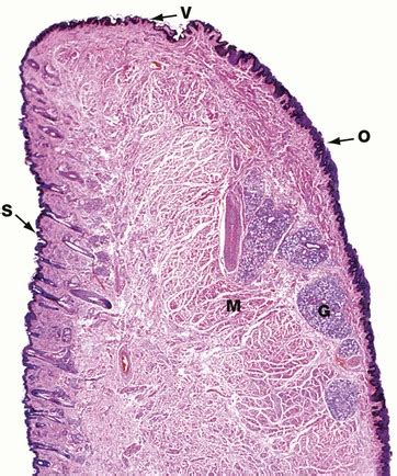 Vermilion Border Of Lip Histology | Sitelip.org