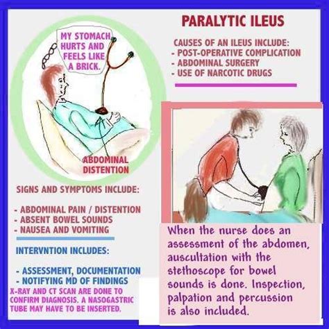 Ileus Symptoms Gallery