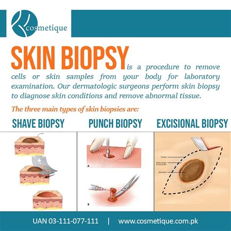 A skin biopsy is a procedure to remove cells or skin samples from your ...