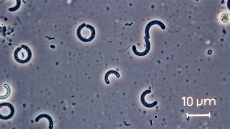 Bacteria Under Compound Microscope