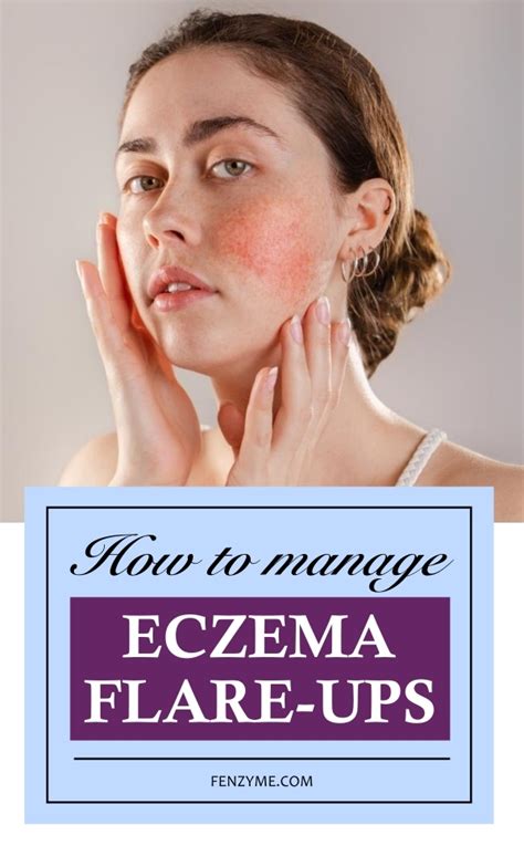 How to Manage Eczema Flare-ups - Fashion Enzyme