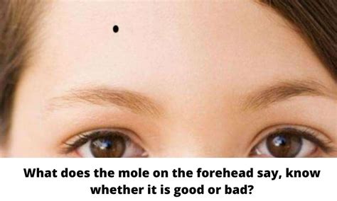 What does the mole on the forehead say know whether it is good or bad ...